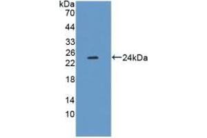 Detection of Recombinant XDH, Mouse using Polyclonal Antibody to Xanthine Dehydrogenase (XDH) (XDH 抗体  (AA 231-416))