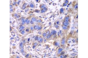 Immunohistochemistry (Paraffin-embedded Sections) (IHC (p)) image for anti-Succinate Dehydrogenase Complex, Subunit A, Flavoprotein (Fp) (SDHA) antibody (ABIN7260583)