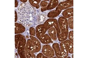 Immunohistochemical staining of human kidney with C11orf54 polyclonal antibody  shows strong cytoplasmic and nuclear positivity in cells in tubules. (C11orf54 抗体)