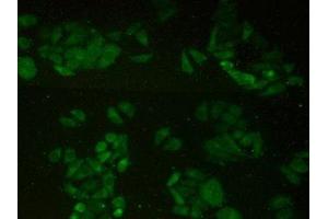 Detection of HIP1R in Human Hela Cells using Polyclonal Antibody to Huntingtin Interacting Protein 1 Related Protein (HIP1R) (HIP1R 抗体  (AA 771-1012))