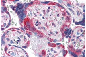 Human Placenta (formalin-fixed, paraffin-embedded) stained with PDGFRA antibody ABIN337400 at 5 ug/ml followed by biotinylated goat anti-rabbit IgG secondary antibody ABIN481713, alkaline phosphatase-streptavidin and chromogen. (PDGFRA 抗体  (C-Term))
