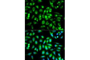 Immunofluorescence analysis of MCF7 cell using CHRM2 antibody. (Muscarinic Acetylcholine Receptor M2 抗体  (AA 208-388))