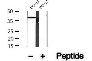 Western blot analysis of extracts of PC-13 cells, using URAT1 antibody. (SLC22A12 抗体)