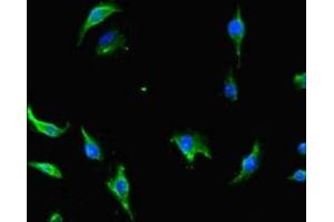 Immunofluorescent analysis of U251 cells using ABIN7147089 at dilution of 1:100 and Alexa Fluor 488-congugated AffiniPure Goat Anti-Rabbit IgG(H+L) (CNOT1 抗体  (AA 604-867))