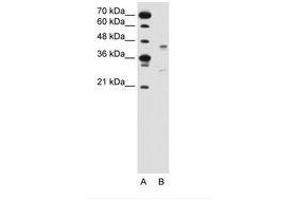 Image no. 2 for anti-G Protein-Coupled Receptor 161 (GPR161) (AA 201-250) antibody (ABIN6736635) (GPR161 抗体  (AA 201-250))