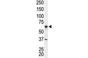 Western blot analysis of IRAK2 antibody and Jurkat cell lysate (IRAK2 抗体  (AA 3-32))