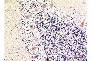 Immunohistochemical analysis of paraffin-embedded Human Brain Tissue using LC3B Mouse mAb diluted at 1:200. (LC3B 抗体)