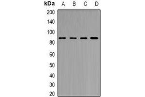 Western blot analysis of YT521-B expression in MCF7 (A), Jurkat (B), mouse brain (C), rat brain (D) whole cell lysates. (YTHDC1 抗体)