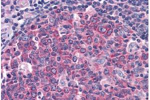 Human Tonsil: Formalin-Fixed, Paraffin-Embedded (FFPE) (IDE 抗体  (AA 349-605))