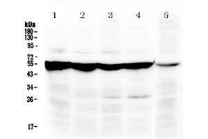 Western blot analysis of PAH using anti-PAH antibody . (Phenylalanine Hydroxylase 抗体  (AA 71-208))