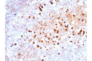 Formalin-fixed, paraffin-embedded human Tonsil stained with Purified IgM Mouse Monoclonal Antibody (IM373). (IGHM 抗体)