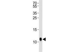 Western blot analysis of lysate from Drosophila tissue lysate using SUMO antibody diluted at 1:1000. (SUMO 抗体  (AA 37-66))