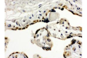 Anti- TIF1 gamma Picoband antibody, IHC(P) IHC(P): Human Placenta Tissue (TRIM33 抗体  (AA 1001-1127))