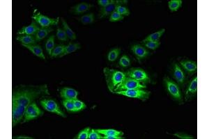 Immunofluorescence (IF) image for anti-Cytochrome B5 Type A (Microsomal) (CYB5A) (AA 2-134) antibody (ABIN7149118)