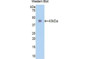 Western blot analysis of the recombinant protein. (CDK2 抗体  (AA 93-211))