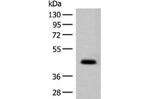 Western blot analysis of Mouse small intestines tissue lysate using GPA33 Polyclonal Antibody at dilution of 1:200 (GPA33 抗体)
