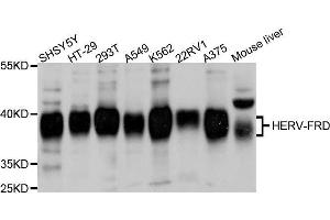 Western blot analysis of extracts of various cell lines, using ERVFRD-1 antibody. (HERV-FRD Provirus Ancestral Env Polyprotein (Herv-frd) (AA 16-250) 抗体)