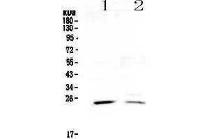 Western blot analysis of StAR using anti-StAR antibody . (STAR 抗体)