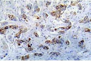 Immunohistochemistry (IHC) analyzes of CaMK2-a antibody in paraffin-embedded human A431 tissue. (CAMK2A 抗体)