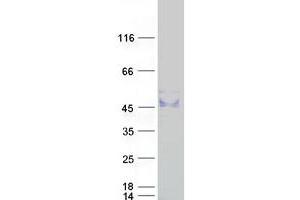 Western Blotting (WB) image for ST3 beta-Galactoside alpha-2,3-Sialyltransferase 1 (ST3GAL1) (Transcript Variant 1) protein (Myc-DYKDDDDK Tag) (ABIN2732741)