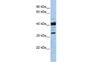 WB Suggested Anti-LRRC57 Antibody Titration: 0. (LRRC57 抗体  (Middle Region))