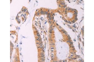 Immunohistochemistry (IHC) image for anti-Adenylate Cyclase 1 (Brain) (ADCY1) antibody (ABIN2432439)