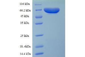 SDS-PAGE (SDS) image for Pyruvate Kinase, Liver and RBC (PKLR) (AA 1-574), (full length) protein (His tag) (ABIN5710105)