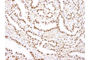 Immunohistochemistry (IHC) image for anti-Nucleolin (NCL) (C-Term) antibody (ABIN7448702)
