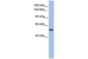 WB Suggested Anti-UBE4A  Antibody Titration: 0. (UBE4A 抗体  (Middle Region))