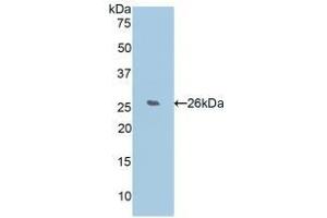 Detection of Recombinant WISP2, Human using Polyclonal Antibody to WNT1 Inducible Signaling Pathway Protein 2 (WISP2) (WISP2 抗体  (AA 24-250))