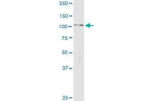 CTNNA2 (Human) IP-WB Antibody Pair