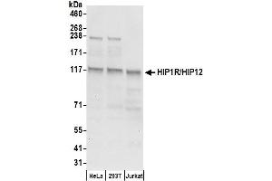 anti-Huntingtin Interacting Protein 1 Related (HIP1R) (AA 300-350) antibody