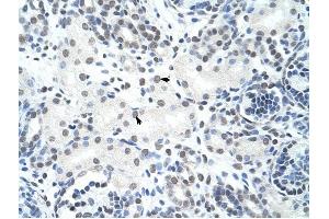 HNRPH3 antibody was used for immunohistochemistry at a concentration of 4-8 ug/ml to stain Epithelial cells of renal tubule (arrows) in Human Kidney.