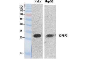Western Blotting (WB) image for anti-Insulin-Like Growth Factor Binding Protein 3 (IGFBP3) (Internal Region) antibody (ABIN3178534) (IGFBP3 抗体  (Internal Region))