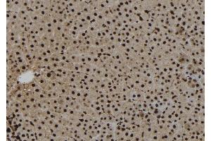 ABIN6273271 at 1/100 staining Rat liver tissue by IHC-P. (NAT10 抗体  (Internal Region))