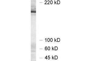 dilution 1 : 1000, sample: synaptic membrane fraction of rat brain (LP1) (UNC13A/Munc13-1 抗体  (AA 3-317))