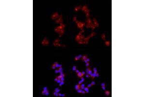 Immunofluorescence analysis of SH-SY5Y cells using G Rabbit pAb (ABIN6131686, ABIN6140882, ABIN6140883 and ABIN6214785) at dilution of 1:350 (40x lens). (GABBR1 抗体  (AA 200-460))