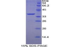 SDS-PAGE analysis of Chicken Annexin V Protein. (Annexin V 蛋白)