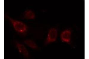 Immunofluorescence (fixed cells) (IF/ICC) image for anti-Cyclin-Dependent Kinase 1 (CDK1) (pTyr15) antibody (ABIN6255816)