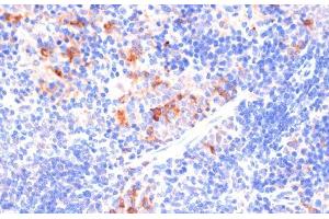Immunohistochemistry of paraffin-embedded Mouse spleen using ARRB1 Polyclonal Antibody at dilution of 1:100 (40x lens). (beta Arrestin 1 抗体)