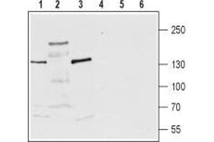 Western blot analysis of rat brain membrane (lanes 1 and 4), rat brain lysate (lanes 2 and 5) and mouse brain lysate (lanes 3 and 6): - 1-3. (TRPM3 抗体  (1st Extracellular Loop))