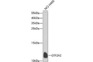 Western blot analysis of extracts of NCI-H460 cells using GTF2A2 Polyclonal Antibody at dilution of 1:1000. (GTF2A2 抗体)