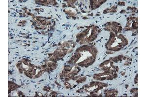 Image no. 1 for anti-SKI-Like Oncogene (SKIL) (AA 307-684) antibody (ABIN1491380) (SKIL 抗体  (AA 307-684))