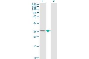 Western Blot analysis of AK3 expression in transfected 293T cell line by AK3 monoclonal antibody (M01), clone 1D2. (Adenylate Kinase 3 抗体  (AA 25-86))