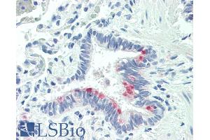 ABIN263186 (5µg/ml) staining of paraffin embedded Human Lung. (MTHFS 抗体  (Internal Region))