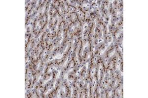 Immunohistochemical staining of human liver with GOLIM4 polyclonal antibody  shows strong cytoplasmic positivity with granular pattern in hepatocytes.