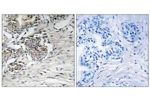 Immunohistochemistry analysis of paraffin-embedded human prostate carcinoma tissue using Claudin 7 (epitope around residue 210) antibody. (Claudin 7 抗体  (Tyr210))