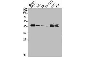 Western blot analysis of mouse-brain HELA KB SH-SY5Y 293T 3T3 lysis using MAGE-C2 antibody. (MAGEC2 抗体  (Internal Region))