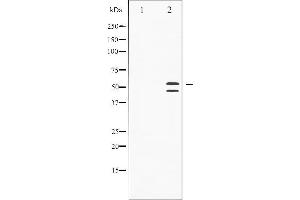 Western blot analysis of SAPK/JNK phosphorylation expression in Anisomycin treated HeLa whole cell lysates,The lane on the left is treated with the antigen-specific peptide. (SAPK, JNK (pThr183) 抗体)