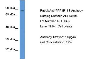 Western Blotting (WB) image for anti-Protein Phosphatase 1, Regulatory Subunit 15B (PPP1R15B) (C-Term) antibody (ABIN2774292) (PPP1R15B 抗体  (C-Term))